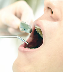 歯科治療イメージ